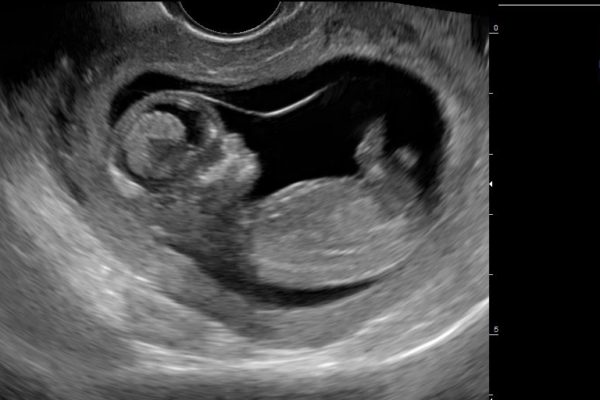Echographe Gynécologie Image clinique