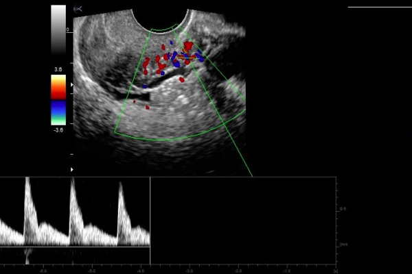 Echographe Gynécologie Image clinique