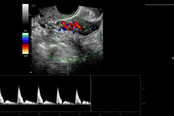 Echographe Gynécologie Image clinique