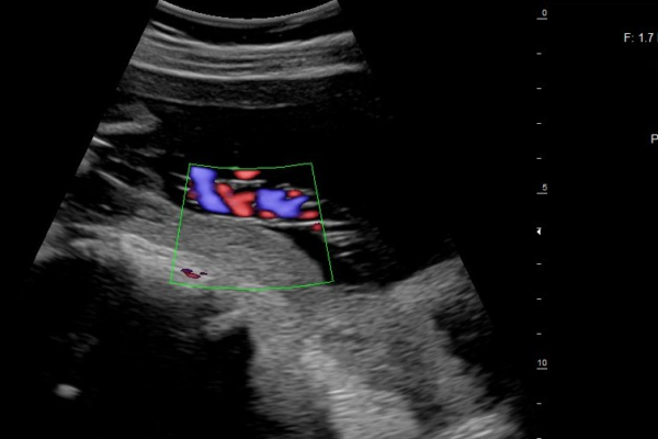 Echographe Gynécologie obstétrique Image clinique