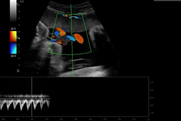 Echographe Gynécologie obstétrique Image clinique