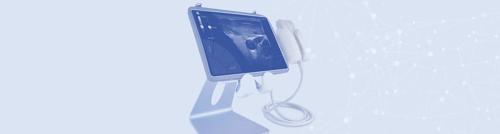 Vygon and Sonoscanner are working together on a new ultrasound scanner, unique among its kind, specifically designed for catheter placement guidance