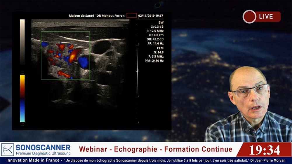 Webinar Echographie médecine generale