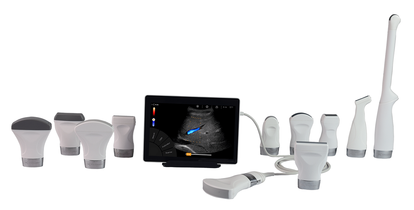 Echographe ultraportable U-Lite Sonoscanner