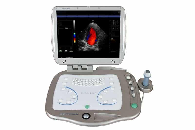 Echographe avec sonde et ecran