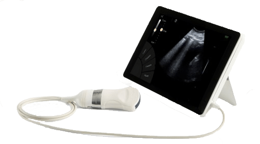 Echographe ultraportable T-Lite Echographie pulmonaire