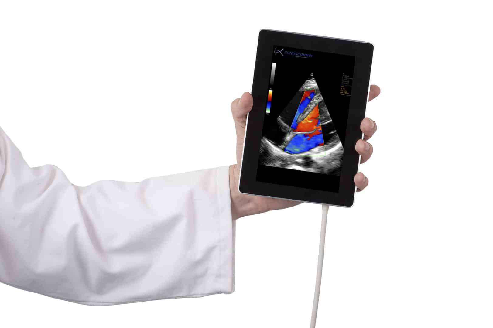 Echographe ultraportable U-Lite Sonoscanner