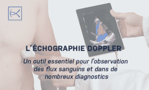L’échographie Doppler : Un outil essentiel pour l’observation des flux sanguins et dans de nombreux diagnostics - Échographie Doppler