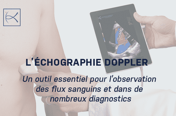 L’échographie Doppler : Un outil essentiel pour l’observation des flux sanguins et dans de nombreux diagnostics - Échographie Doppler