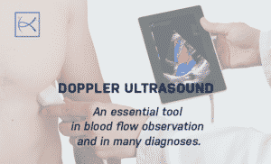 Doppler Ultrasound: An essential tool in blood flow observation and in many diagnoses. - La conception des produits