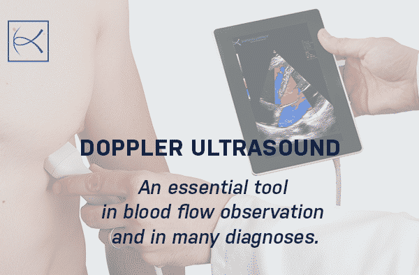 Doppler Ultrasound: An essential tool in blood flow observation and in many diagnoses. - La conception des produits