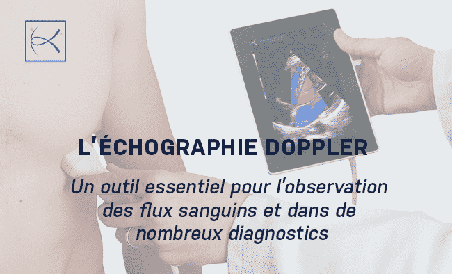 L’échographie Doppler : Un outil essentiel pour l’observation des flux sanguins et dans de nombreux diagnostics