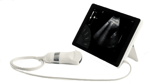 Echographe ultraportable T-Lite Echographie pulmonaire