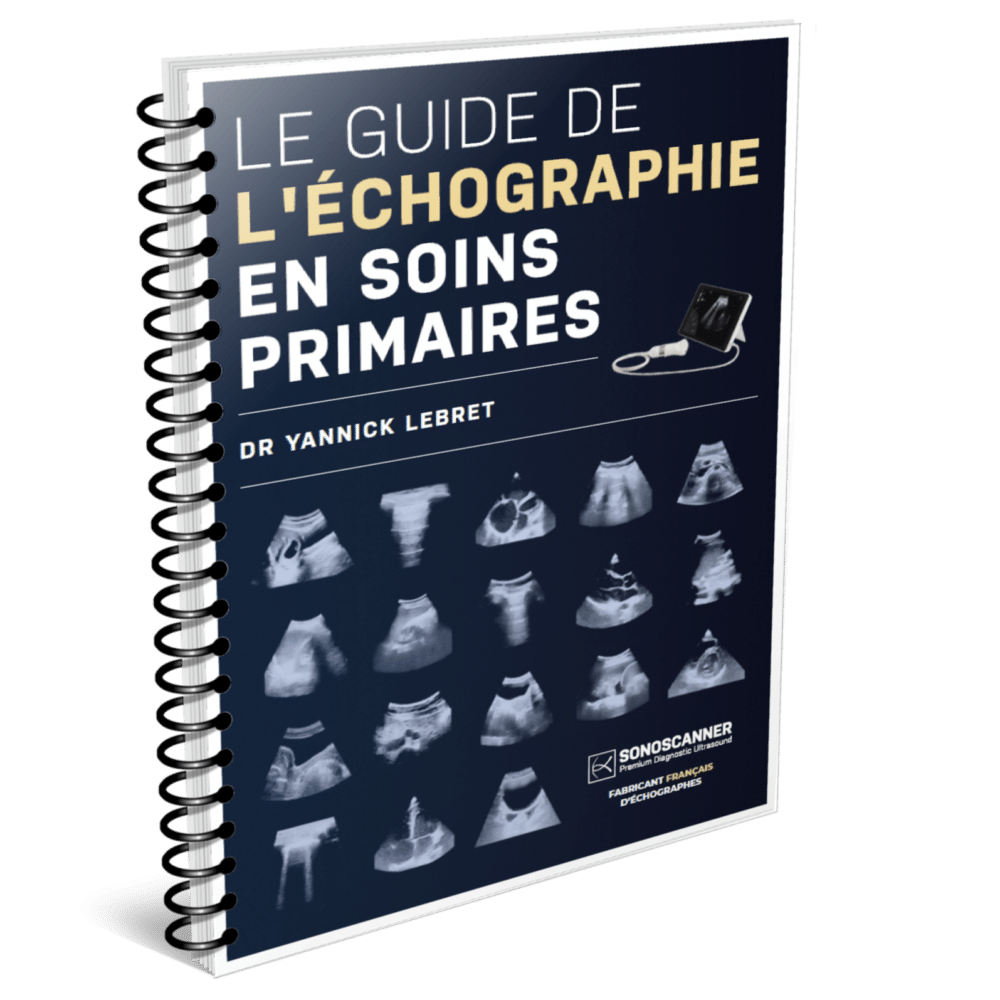 Guide Pratique De L Echographie Obstetricale Et Gynecologique