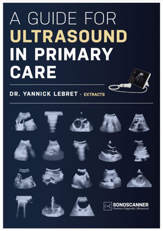 Guide for ultrasound in primary care Sonoscanner