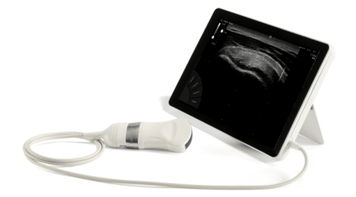 Echographe ultraportable T-Lite Sonoscanner