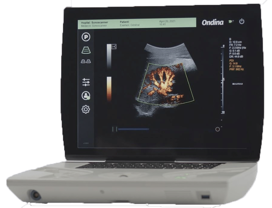 Echographe portable hybride Ondina Sonoscanner