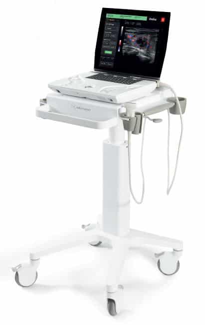 Echographe Sonoscanner portable Ondina