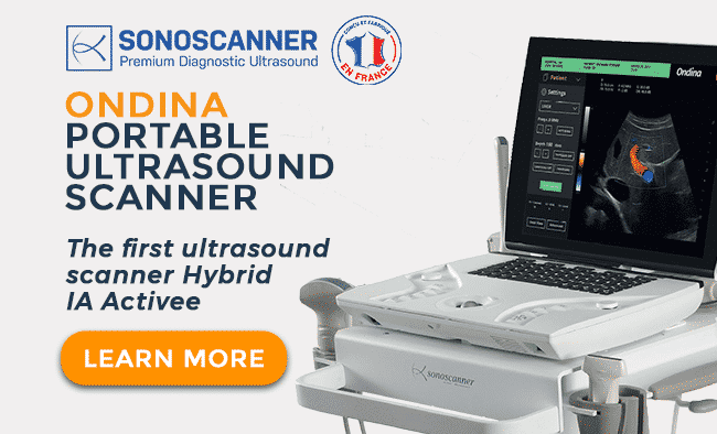 Portable Ultrasound Ondina Sonoscanner
