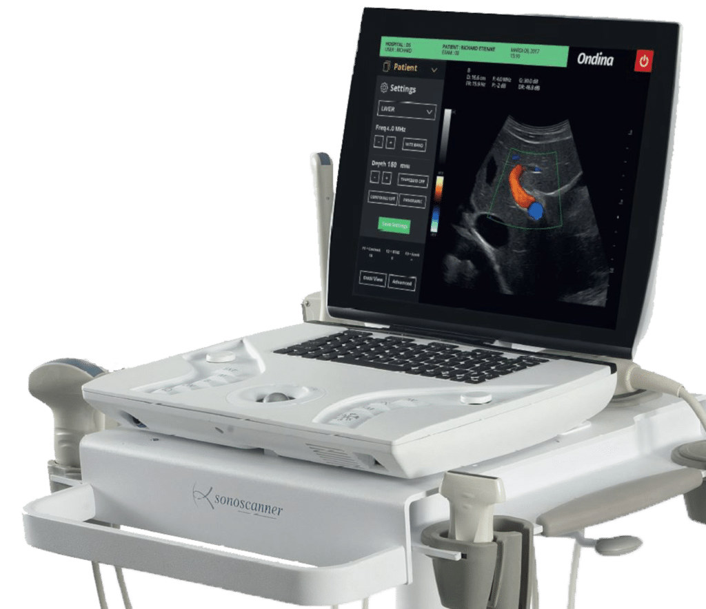 Sonoscanner – Leader français de l'Échographe