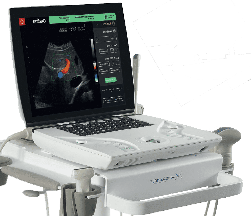 Sonoscanner : Premium Diagnostic Ultrasound