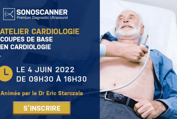 Atelier Coupes de bases en cardiologie - Échographie