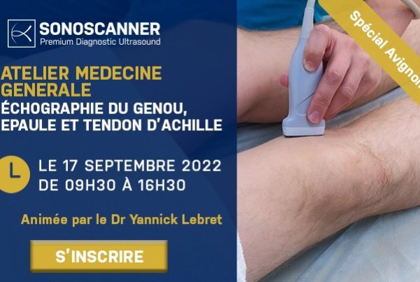 Atelier | Echographie du genou, épaule et tendon d'Achille | Avignon - physique