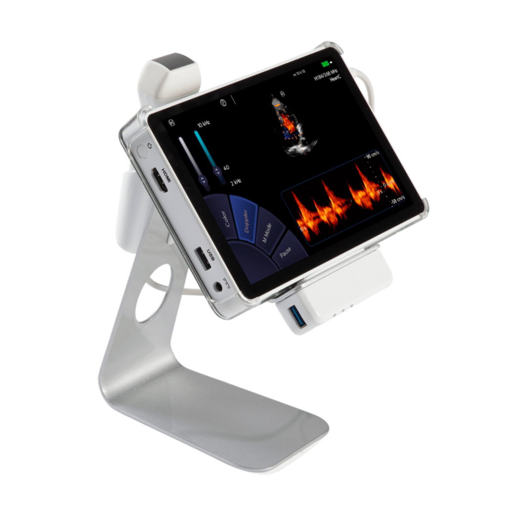 U-Lite Pro échographie ultraportable cardiologie