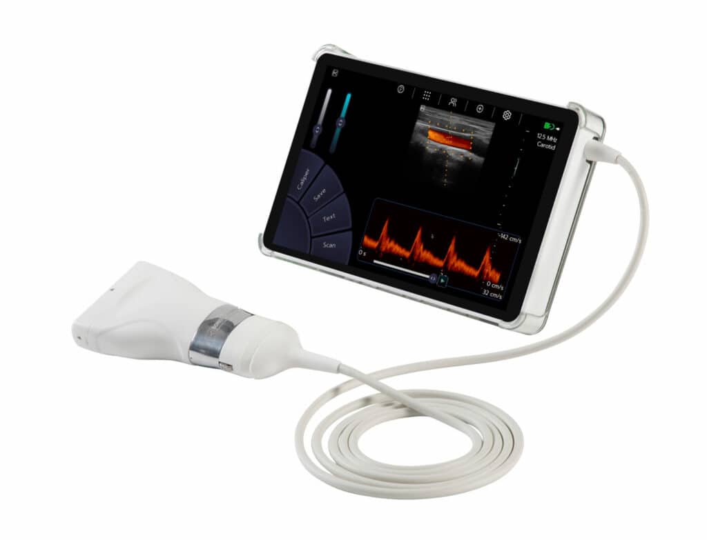 Radiology Ultrasound Scanner Machine - Sonoscanner