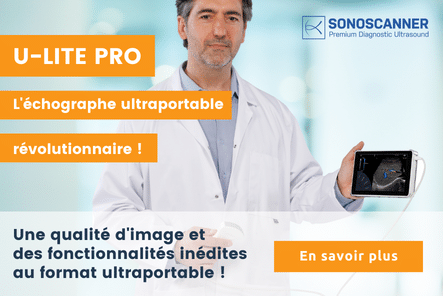 Découvrez l’échographe ultraportable U-Lite PRO