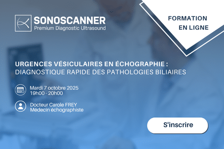 Webinar | Urgence vésiculaires en échographie | Docteur Frey
