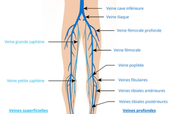 schéma anatomique thrombose veineuse profonde échographie